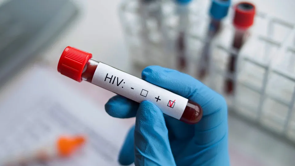 Cientistas desenvolvem nanopartículas de mRNA que podem levar à cura do HIV