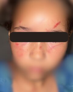 Homem é preso em flagrante por agressão à ex-companheira e filha de 8 anos