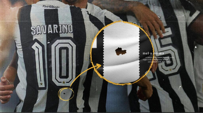 Campanha do Botafogo que alerta sobre melanoma vence prêmio internacional » Alagoas Notícia Boa