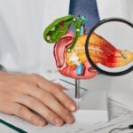 Crescem casos de câncer de pâncreas antes dos 50 anos; aumento é maior entre mulheres