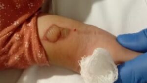 Polícia investiga morte de bebê em hospital, e família diz que medicação foi trocada: 'Nome da outra criança'